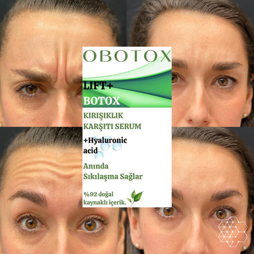 OBOTOX BOTOX ETKİLİ SERUM - KIRIŞIKLIK GİDERİCİ YAŞLANMA KARŞITI CİLT GENÇLEŞTİRİCİ ETKİSİ İLE BOTOX ETKİSİ