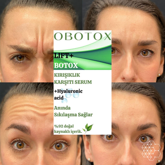 OBOTOX BOTOX ETKİLİ SERUM - KIRIŞIKLIK GİDERİCİ YAŞLANMA KARŞITI CİLT GENÇLEŞTİRİCİ ETKİSİ İLE BOTOX ETKİSİ